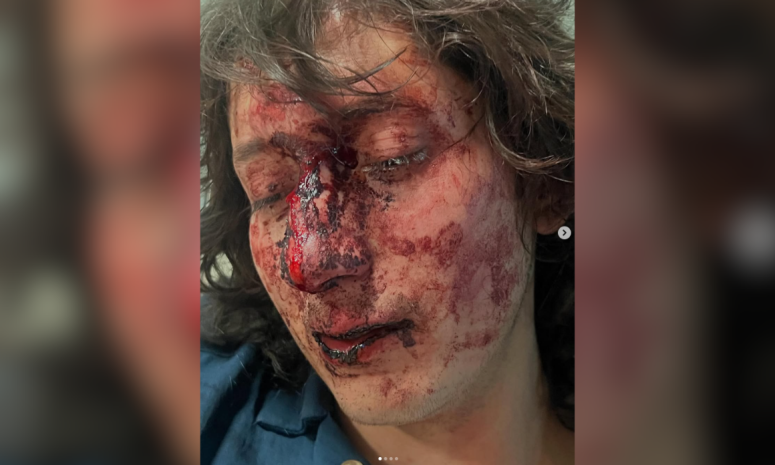 Denuncian agresión en bar Mentiras Zona de Despecho en Pachuca
